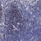 Immunohistochemical staining of human lymph node shows high expression.