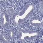 Immunohistochemical staining of human endometrium shows low expression as expected.