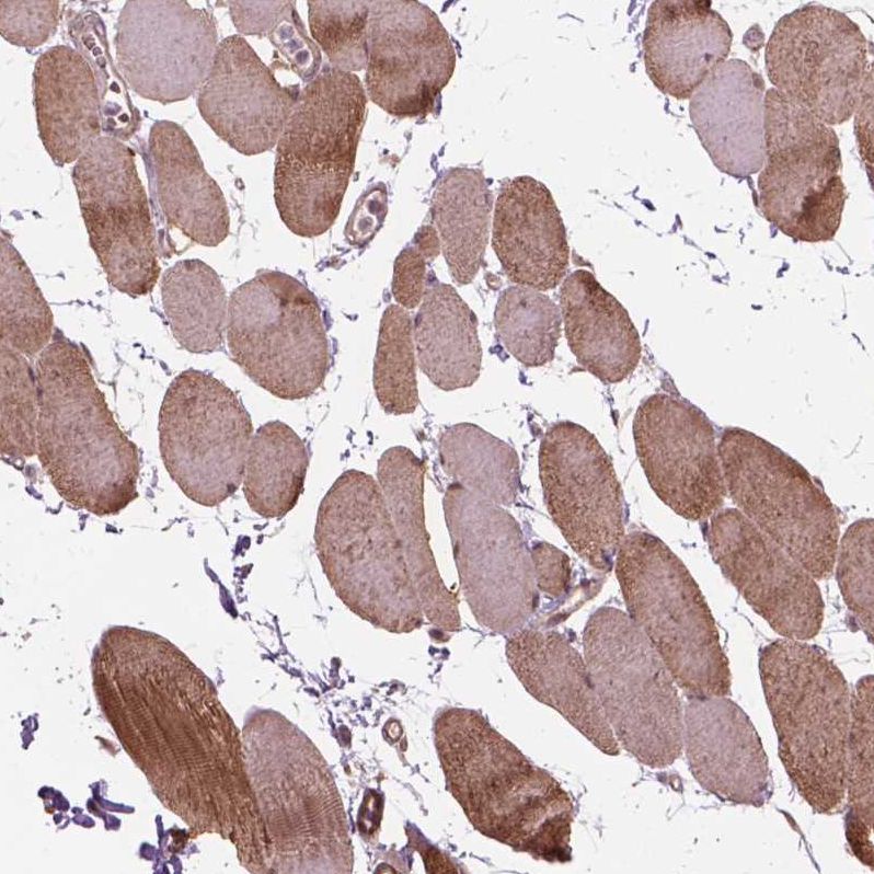 Anti-PSMD11 Antibody