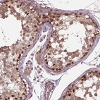 Immunohistochemical staining of human testis shows strong cytoplasmic and nuclear positivity in cells in seminiferous ducts.