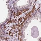 Immunohistochemical staining of human prostate shows strong cytoplasmic positivity in smooth muscle cells.