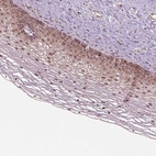 Immunohistochemical staining of human cervix, uterine shows strong cytoplasmic and nuclear positivity in squamous epithelial cells.