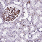Immunohistochemical staining of human kidney shows strong membranous positivity in cells in glomeruli.