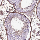 Immunohistochemical staining of human testis shows moderate membranous positivity in peritubular myoid cells.