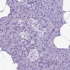 Immunohistochemical staining of human pancreas shows low positivity in exocrine glandular cells as expected.