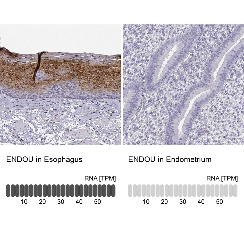 Anti-ENDOU Antibody