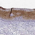 Immunohistochemical staining of human esophagus shows strong cytoplasmic positivity in squamous epithelial cells.