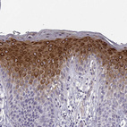Immunohistochemical staining of human skin shows strong cytoplasmic positivity in squamous epithelial cells.