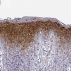 Immunohistochemical staining of human skin shows strong cytoplasmic positivity in squamous epithelial cells.