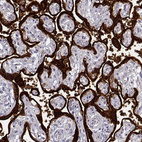 Immunohistochemical staining of human placenta shows very strong cytoplasmic positivity in trophoblastic cells.