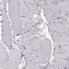 Immunohistochemical staining of human skeletal muscle shows no positivity in myocytes as expected.