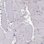Immunohistochemical staining of human skeletal muscle shows no positivity in myocytes as expected.
