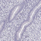 Immunohistochemical staining of human endometrium shows no positivity in glandular cells as expected.