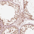 Anti-GMEB2 Antibody