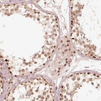 Anti-GMEB2 Antibody