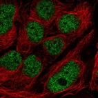 Immunofluorescent staining of human cell line CACO-2 shows localization to nucleoplasm.