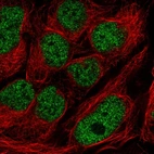 Immunofluorescent staining of human cell line CACO-2 shows localization to nucleoplasm.