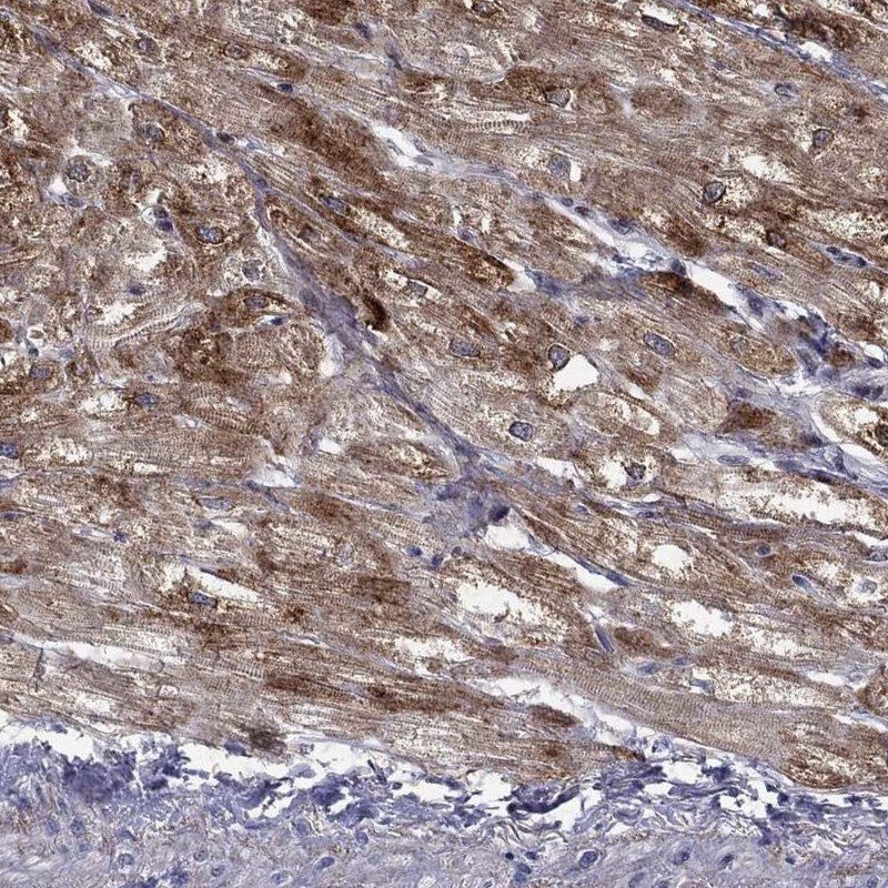 Anti-PTGDS Antibody