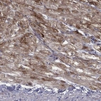 Anti-PTGDS Antibody