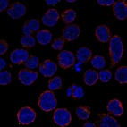 Anti-TNFAIP3 Antibody