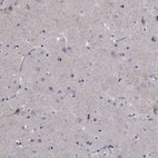 Immunohistochemical staining of human cerebral cortex shows low expression as expected.
