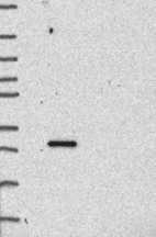 Lane 1: Marker [kDa] 250, 130, 95, 72, 55, 36, 28, 17, 10 | Lane 2: RT4 | Lane 3: U-251 MG | Lane 4: Human Plasma | Lane 5: Liver | Lane 6: Tonsil