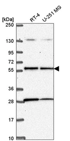 Anti-STK11 Antibody