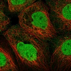 Immunofluorescent staining of human cell line A-431 shows localization to nucleoplasm & cytosol.
