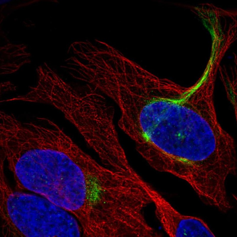 Anti-C19orf25 Antibody