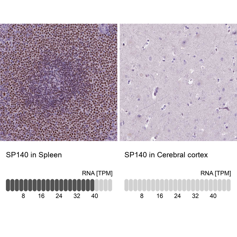 Anti-SP140 Antibody