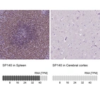 Anti-SP140 Antibody