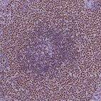 Anti-SP140 Antibody