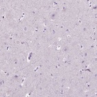 Immunohistochemical staining of human cerebral cortex shows low expression as expected.