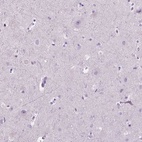 Anti-SP140 Antibody