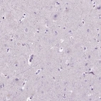 Immunohistochemical staining of human cerebral cortex shows low expression as expected.