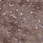 Immunohistochemical staining of human cerebral cortex shows high expression.
