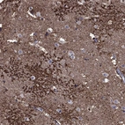 Immunohistochemical staining of human cerebral cortex shows high expression.