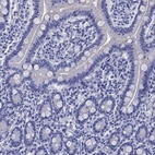 Immunohistochemical staining of human small intestine shows low expression as expected.
