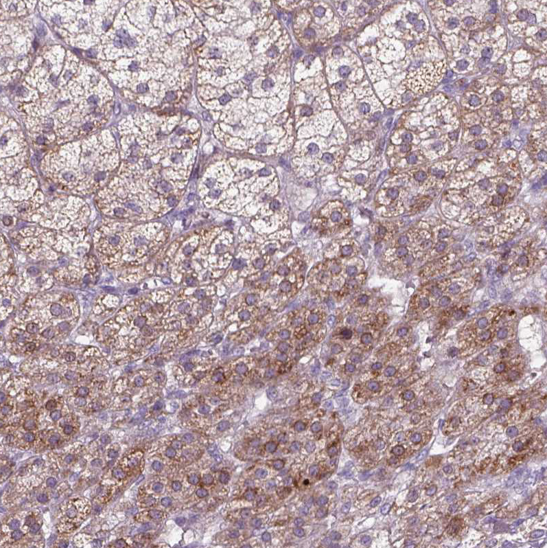 Anti-ADGRV1 Antibody