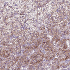 Anti-ADGRV1 Antibody