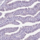 Immunohistochemical staining of human fallopian tube shows no positivity in glandular cells as expected.