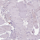 Anti-ADGRV1 Antibody