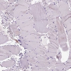 Immunohistochemical staining of human skeletal muscle shows no positivity in myocytes as expected.