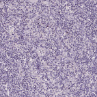 Immunohistochemical staining of human lymph node shows no positivity in germinal center cells as expected.
