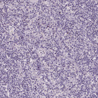 Anti-ADGRV1 Antibody