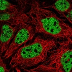 Immunofluorescent staining of human cell line CACO-2 shows localization to nucleoplasm.