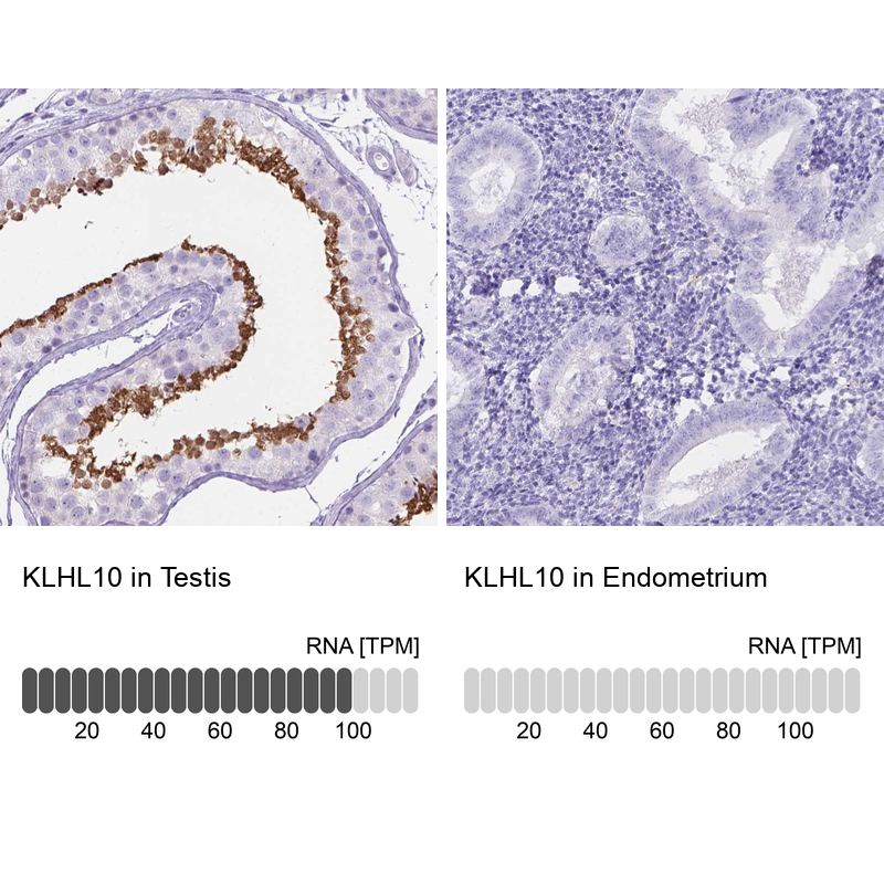 Anti-KLHL10 Antibody