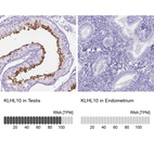 Anti-KLHL10 Antibody