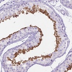 Immunohistochemical staining of human testis shows high expression.