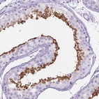 Immunohistochemical staining of human testis shows high expression.